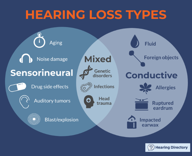 Illustration explaining the three main types of hearing loss: sensorineural, conductive and mixed.