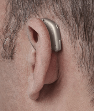 A close-up of an ear with a RITE hearing aid.